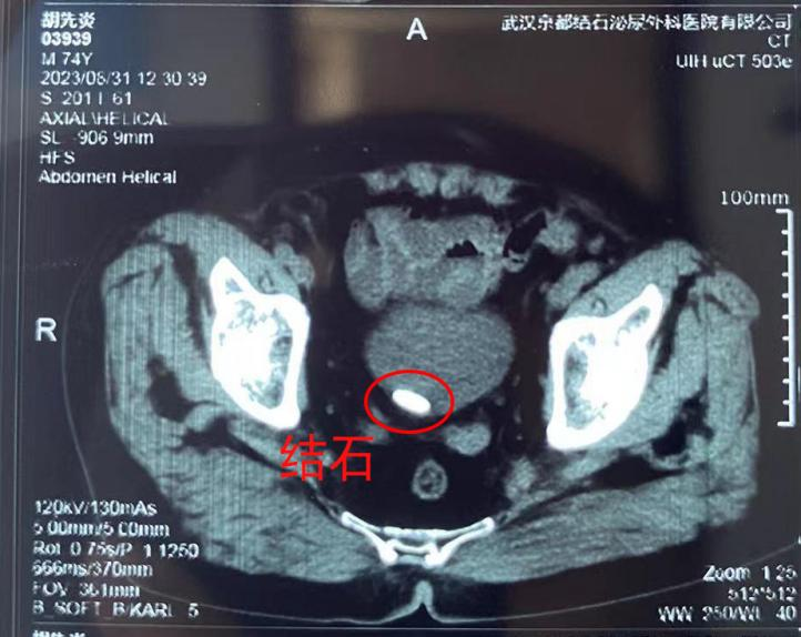 1703403132128100.png 22.png